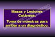 Masas y Lesiones Cutáneas. Toma de muestras para arribar a un …laboduchene.com/Biopsiacutanea-face.pdf · 2013-08-20 · La biopsia cutánea puede ser concluyente u orientativa