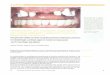 sirius1 - Kuss Dental quintessence... · 2019-09-23 · El elemento retentivo totalmente cerámico (fig. 2) ofre- ... vacio parcial que se forma a' separar la parte hembra de la parte
