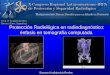 Protección Radiológica en radiodiagnóstico: énfasis en ... · Protección Radiológica en radiodiagnóstico: énfasis en tomografía computada . ... Sistemas Hibridos: PET-CT,