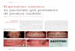 content cosmetic dentistry Ripristino estetico in …...content _ cosmetic dentistry dentistry 4 _207 25 cosmeic Figg. 11a-11c_Montaggio denti. Figg. 12a, 12b_L’occlusione lingualizzata
