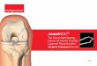 JewelACL - Neoligaments · 2019-07-31 · The JewelACL thus offers unprecedented flexibility in ACL reconstruction by the way of approach, graft selection and graft anchoring to the
