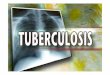 What is TB? - USMF · 2019-03-04 · Robert Koch proved to German doctors that bacilli caused TB He became known as The Father of Bacteriology ... 1882, Koch discovers mycobacterium