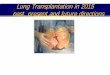 Lung Transplantation in 2015 past, present and future ... · Lung Transplantation in 2015 past, present and future directions Rajat Walia, MD FCCP Medical Director, Lung Transplant