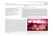 REVISIÓN BIBLIOGRÁFICA Infiltration of White-Spot-Lesions ...REVISIÓN BIBLIOGRÁFICA Infiltration of White-Spot-Lesions and developmental enamel defects Michael Knösel1*, Roberto