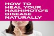 HOW TO HEAL YOUR HASHIMOTO’S DISEASE NATURALLY · 2019-07-19 · Hashimoto’s disease may begin to develop, ... Natural food refers to whole, unprocessed foods Fast food contains