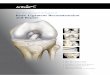 The most advanced Techniques in Knee Ligament ... Transtibial ACL Reconstruction ACL Cruciate ToolBox