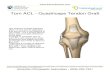 Torn ACL - Quadriceps Tendon Graft ... Torn ACL - Quadriceps Tendon Graft The anterior cruciate ligament