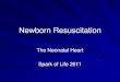 Newborn Resuscitation Newborn Resuscitation Newborn resuscitation all about breathing ¢â‚¬â€œAeration of
