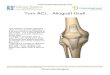 Torn ACL - Allograft Graft - Pinehurst ... Torn ACL - Allograft Graft The anterior cruciate ligament