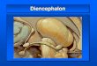 Diencephalon - anatomy.plcnet.organatomy.plcnet.org/files/Lectures/English_1_2/2019/thalamus_dm.pdf · Diencephalon dorsal surface . Diencephalon ventral surface . Diencephalon Medial