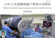 ロボット支援腹腔鏡下腎部分切除術 - shimane-u.ac.jp...手術の様子 ロボット支援腹腔鏡下腎部分切除術 Robot assisted laparoscopic partial nephrectomy