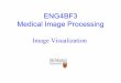 ENG4BF3 Medical Image Processing - McMaster Universityxwu/Visualization.pdf · • Visualization of 3D volume images can be divided into two techniques characteristically: surface