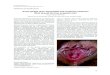 Acute genital ulcer associated with erythema nodosum What ... · study if needed. The differential diagnosis of genital ulcers includes a vast variety of both infectious and non-infectious