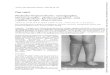 Case report Pachydermoperiostosis: scintigraphic ... · graphic studies revealed typical findings of multiple epiphyseal dysplasia (MED),P-` with defective epiphyseal development,