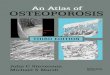 Atlas of Osteoporosis › resources › Atlas of...AN ATLAS OF OSTEOPOROSIS 2 Figure 1.1 Incidence rates for the three most common osteoporotic fractures, plotted as a function of