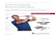 LDR Prostate Brachytherapy - BEBIG · established itself as a leading European LDR prostate brachytherapy provider with over 4 million seeds sold and 55,000 patients treated. Besides