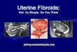 Uterine Fibroids - Scbtmr Uterine Fibroid. Ovarian Vascular Pedicle Sign ¢â‚¬¢If you can trace gonadal