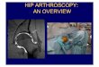 Review causes of hip and groin pain in athlete Discuss ... › parousiasis › hip › 72.pdf · PDF file Review causes of hip and groin pain in athlete Discuss indications for hip