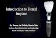 Introduction to Dental implant · What is a dental implant? The prosthesis: it is either single crown, fixed partial denture, over denture or any type of restoration connected to