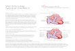 Ventricular Congenital & Septal Defect Children’s Heart Centre septal defect.pdf · Ventricular septal defect (VSD) is a condition whereby there is a hole between the two pumping