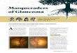 Masqueraders of Glaucomav2.glaucomatoday.com/pdfs/0119GT_F4_Cases.pdf · 2019-01-29 · DIFFERENTIAL DIAGNOSIS s JANUARY/FEBRUARY 2019 | GLAUCOMA TODAY 49 3. Zalta AH. Lens rim artifact
