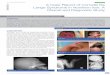A case report of cornelia de lange syndrome in Northern Iran; a … · 2017-04-13 · Seyyed-Mohsen Hosseininejad et al., A Case Report of Cornelia De Lange Syndrome in Northern Iran