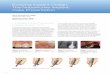 Evolving Implant Design. The NobelActive Implant: Case Presentationnobelbiocare.dentalaegis.com/pdfs/Nobel_Orentlicher.pdf · 2010-08-27 · Evolving Implant Design. The NobelActive