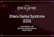 Ehlers-Danlos Syndrome (EDS) · Ehlers-Danlos Syndrome • Problem with the proteins that make up connective tissue. Collagen is most frequently implicated. • Proteins and/or their