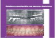 Ortodoncia predecible con aparatos invisibles · 2012-11-19 · MAXILLARIS, octubre 2009 85 gía, con sus avances en 3D, digitalización, escáner de cono cor-to y Cad-Cam, ha implementado