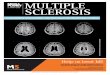 Multiple sclerosis:Layout 1doc.mediaplanet.com/all_projects/1566.pdf · Multiple sclerosis (MS) is a devastating and ... you need to understand the basics of the body’s central