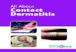 All About Contact Dermatitis ... l Nappy rash (also called diaper rash, nappy dermatitis, diaper dermatitis or irritant diaper dermatitis) is one of the most common skin conditions