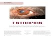 Normalt öga. Entropion - Svenska Kennelklubben · PDF file förklara hur fyra olika typer av entropion uppkommer. Entropion hos shar pei, som orsakas av mucinos, behandlas inte här