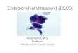 Endobronchial Ultrasound (EBUS) · 2020-01-21 · EBUS-TBNA • Provides real time image of the mediastinal structures adjacent to the airway • The ntegration of ultrasound technology