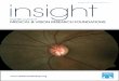 Scientiﬁ c Journal of MEDICAL & VISION RESEARCH … · recession, pigment dispersion syndrome and endogenous hypercortisolism (5–10). Steroid responsiveness follows a bimodal