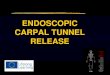 ENDOSCOPIC CARPAL TUNNEL RELEASEtelearn.tu-sofia.bg/.../cts_release_module1_task1.pdf · ENDOSCOPIC CARPAL TUNNEL RELEASE. Carpal Tunnel Syndrome • Compression of the median nerve
