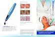 Cr Cryo yo TM · 2016-12-23 · Removal of skin tags, warts, age spots PERFECTING YOUR SKIN, ALL OVER The Cryo TM allows you to make your skin flawless, all over. With it’s quick
