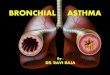 BRONCHIAL ASTHMAkanpuruniversity.org/pdf/Bronchial-Asthma_070520.pdfIntroduction Asthma is a chronic inflammatory disorder ofthe airways that ischaracterized: clinically by recurrent