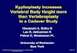 Kyphoplasty increases Vertebral Body Height more than ... · Materials & Methods •!Cadavers –!37 vertebral bodies (21 T, 16 L-spine) –!mean 82 years Kyphoplasty (n = 19) –!Vertebroplasty