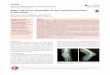 Volume 6, Issue 1, 2020, p. 47-49 Giant cell tumor of ... · 4. Campanacci M, Baldini N, Boriani S, Sudanese A. Giant-cell tumor of bone. J Bone Joint Surg Am 1987; 69(1): 106-14