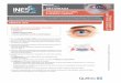Atteintes oculaires à herpès simplex · ATTEINTES OCULAIRES À HERPÈS SIMPLEX Consulter les mises à jour de ce guide à inesss.qc.ca PRÉSENTATION CLINIQUE Une atteinte oculaire