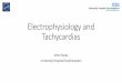 Electrophysiology and Tachycardias - BJCA) Horizons · PDF file a narrow complex tachycardia consults regarding treatment. ECG in sinus is normal, echo shows a structurally normal