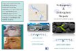 Ectropion Entropion Repair - Coastal Eye · PDF file Entropion Repair orrective eyelid surgery (207) 667-6300 www. oastalEyeare.net 128 ucksport Road Ellsworth, ME 04605 If you are
