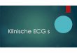 Klinische ECG s · presentatie:-mug interventie, -collaps met kortdurend bewustzijnsverlies -kort na het eten-pob --hartkloppingen ++-tachycardie hr 180-200/min