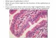 What type of epithelium is this? What do you think might ...€¦ · epithelium • How does this epithelium differ from that of the cervix? The surface of the epithelium bears a