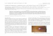 Pediatric pulmonary actinomycosis: Case report and review ... · Pulmonary actinomycosis is a rare infection in infants and children. Because of its non-specific clinical presentation,