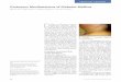 Cutaneous Manifestations of Diabetes Mellitus...type 1 diabetes, 39% of patients with type 2 diabetes, and 2% of control subjects (9). However, a more recent study found that DD is