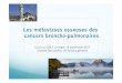 Cours du GOLF, Limoges 19 septembre 2017 Chantal ...splf.fr/wp-content/uploads/2017/10/Decroisette-C... · Les métastases osseuses des cancers broncho-pulmonaires Cours du GOLF,