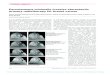 Percutaneous minimally invasive stereotactic primary ...rmhkjsv/papers/2002AprLancetOncol Targit-… · Fisher Mammotest table for digital real-time tumour localisation, (b) the Mammotome