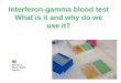 Interferon-gamma blood test What is it and why do we use it? · 2020-07-17 · • Blood samples from TB-infected animals will release greater amounts of IFNγ in response to bovine