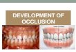 DEVELOPMENT OF OCCLUSION · • MIXED DENTITION • A) Anterior deep bite • B) Mandibular anterior crowding • C) Ugly duckling stage • D) End-on relation • CORRECTION •